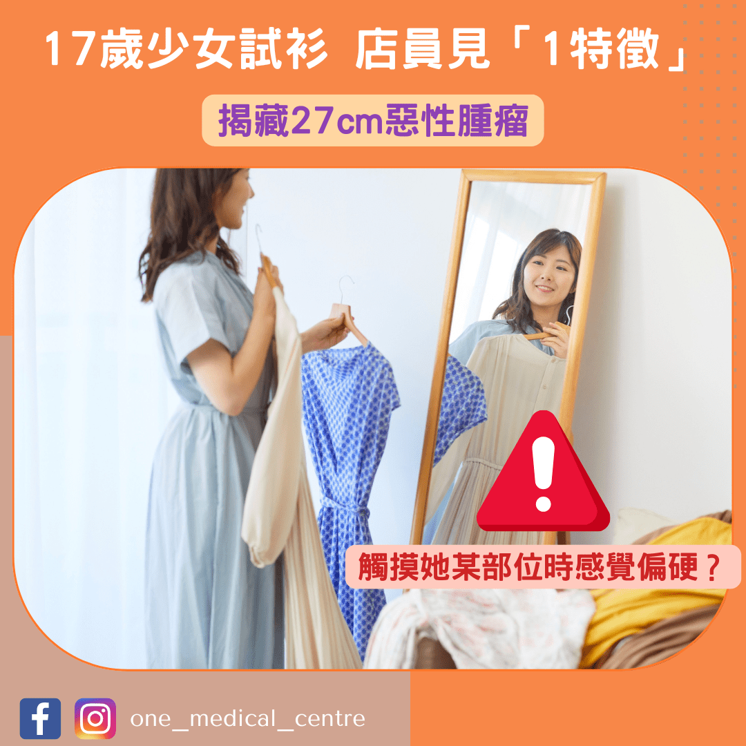【17歲少女行街試衫　店員見「1特徵」提醒驗身　揭藏27cm惡性腫瘤】